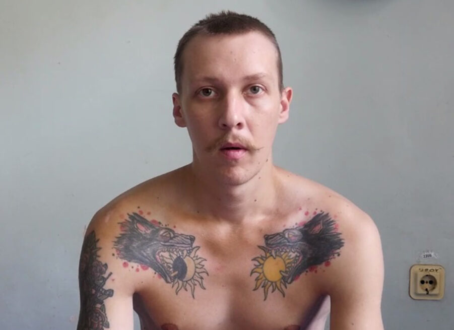 Український військовополонений з батальйону «Азов» Олександр Максимчук у лікарні після вибуху в Оленівці. Фото з анонімного телеграм-каналу "ДНР"